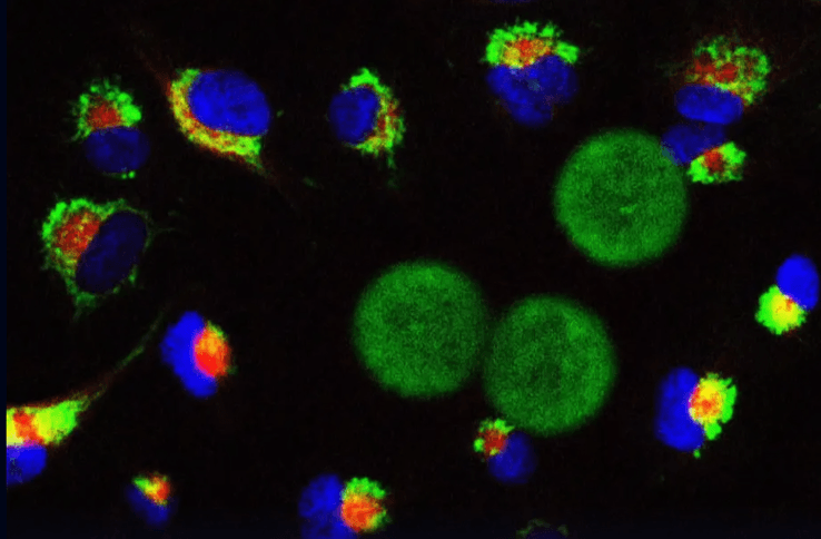 Microrobot for Cancer Theranostics